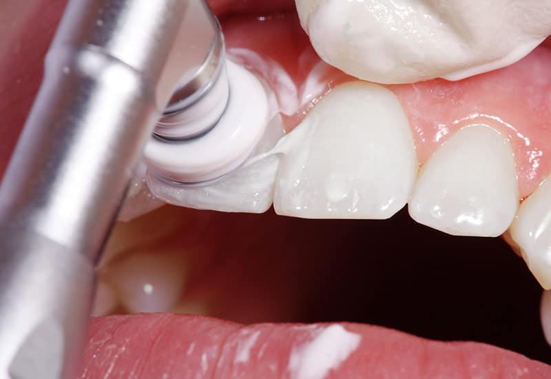 Zahnsanierung​
